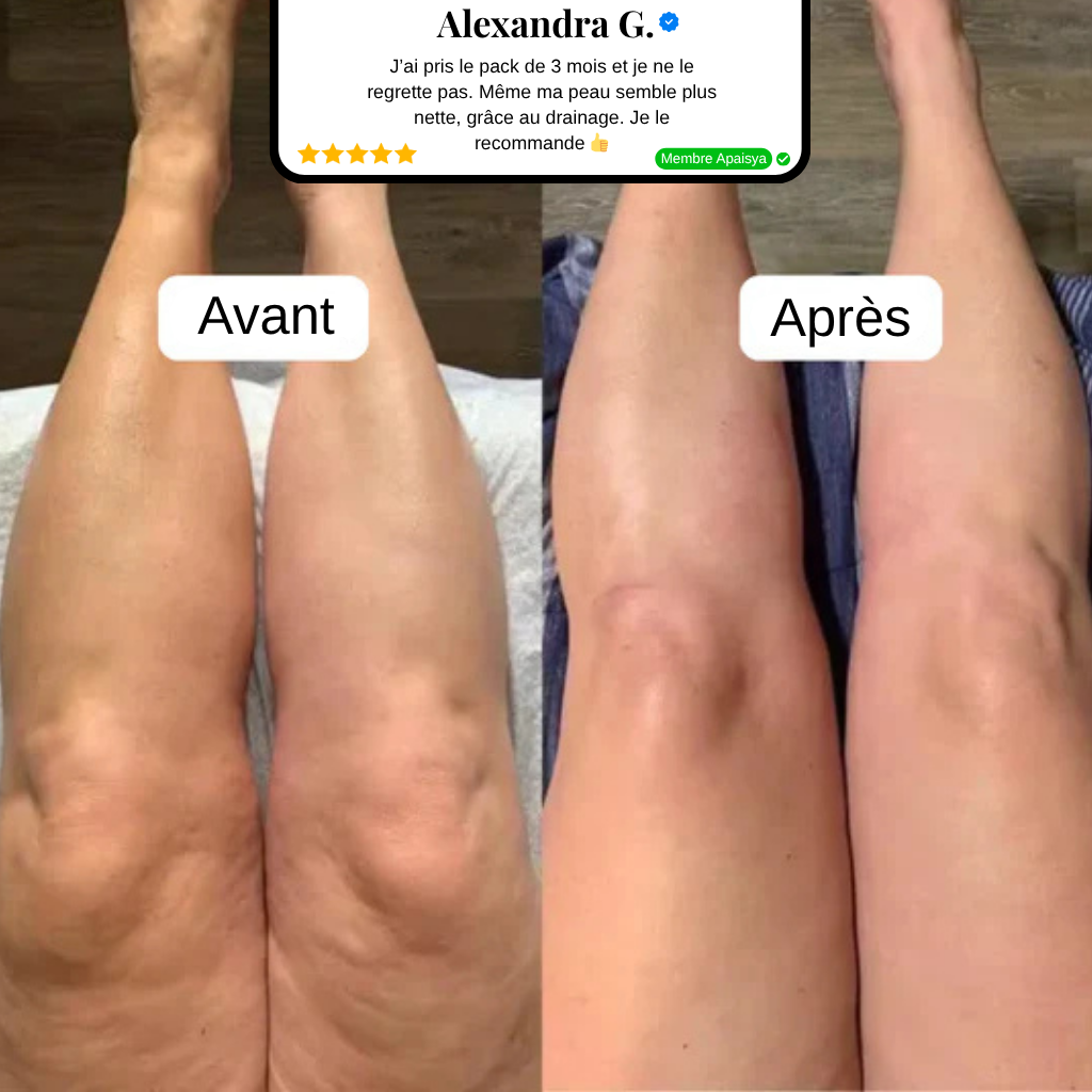 Drainage Lymphatique Sculptique™ | Apaisya