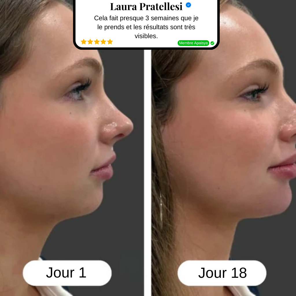 Drainage Lymphatique Sculptique™ | Apaisya